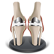  icon of two knees that have been replaced