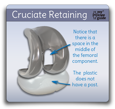 total Knee Components, posterior stabilized followed by cruciate retaining