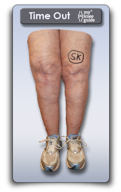 Time Out site marking on knee by surgeon