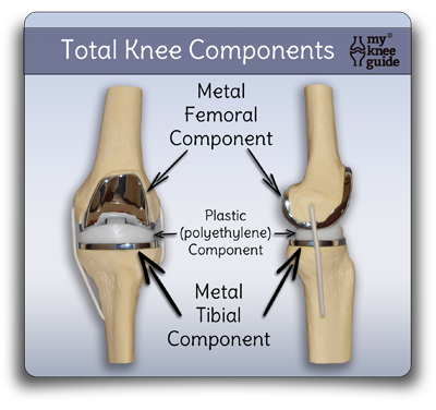 knee joint replacement devices